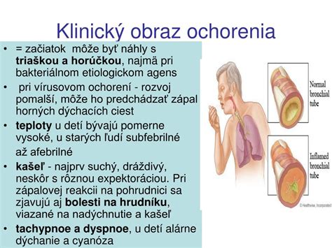 Infografika o vírusových ochoreniach u detí