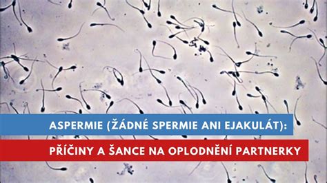 Ilustrácia procesu oplodnenia a cesty spermií