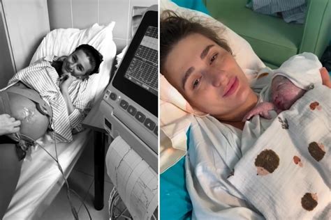 Schéma znázorňujúca postup pôrodu a polohy matky.