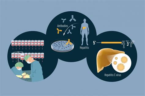 Infografika o globálnej prevalencii hepatitídy B a C