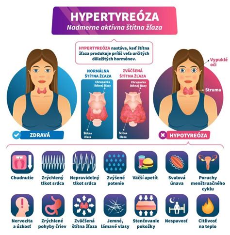 Infografika porovnávajúca príznaky a následky hypotyreózy a hypertyreózy