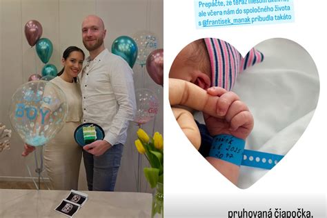 Fotka bábätka s náramkom z pôrodnice