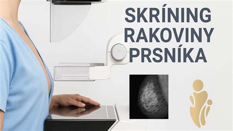 Ilustrácia prevencie rakoviny prsníka