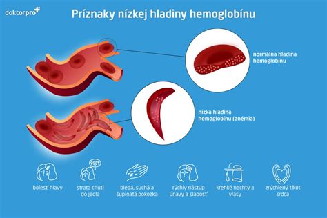 Infografika zobrazujúca príznaky nízkej hladiny estrogénu