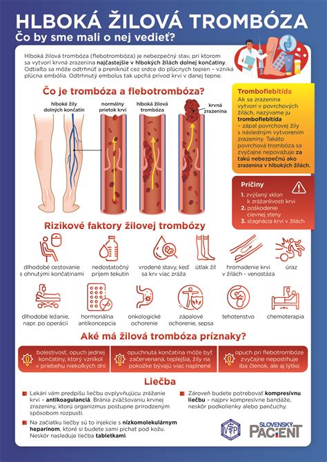 Infografika zobrazujúca prejavy mdloby