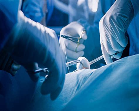 Chirurgická operácia dvojičiek v maternici