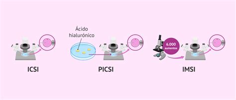 infografika o ICSI a PICSI metódach