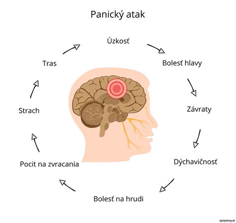 Schéma zvládania panickej ataky