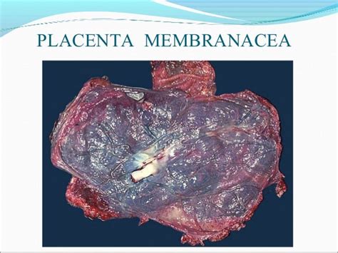 Ilustrácia placenta membranacea
