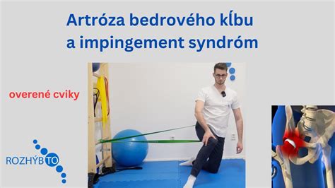 Schéma bedrového kĺbu novorodenca