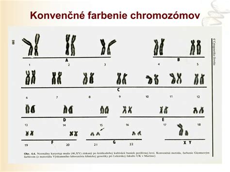 Shematické znázornenie chromozómov X a Y