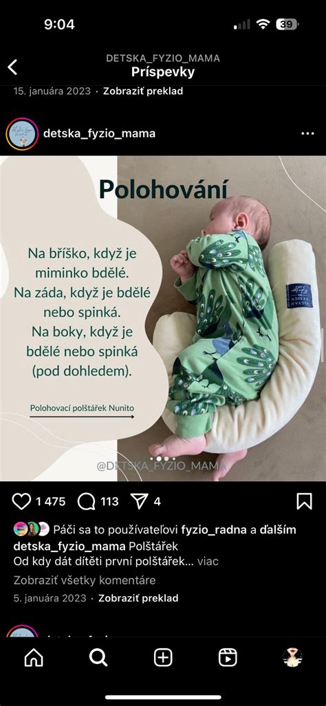 Ilustrácia hlavičky bábätka s naznačenou tendenciou k splošteniu.