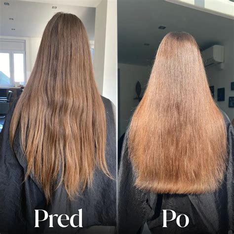 rôzne druhy vitamínov pre rast vlasov