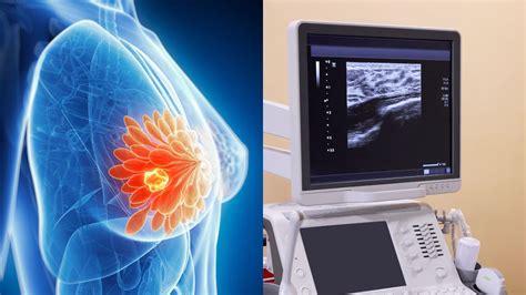 Ilustrácia porovnávajúca ultrazvuk a mamografiu prsníkov