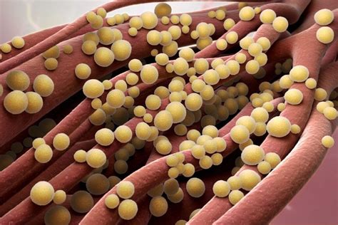Prehľad najčastejšie predpisovaných antiepileptík