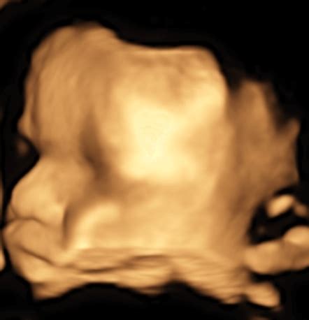 Ultrazvukové zobrazenie placenty a pupočníka