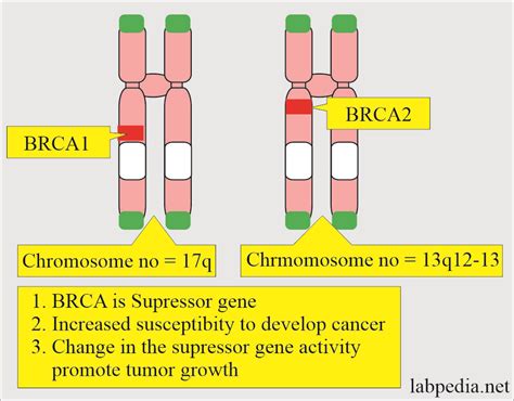 Infografika znázorňujúca gény BRCA1 a BRCA2 a ich súvislosť s rakovinou prsníka a vaječníkov