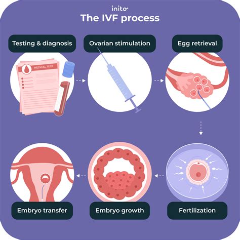 Ilustrácia procesu IVF