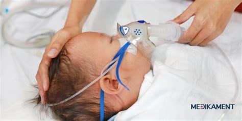 Ilustrácia respiračného syncyciálneho vírusu (RSV)