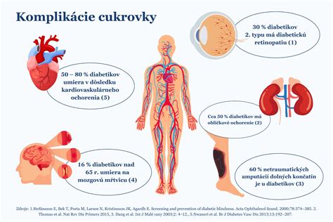 Infografika zobrazujúca komplikácie cukrovky