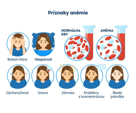 Tabuľka porovnávajúca príznaky a liečbu rôznych typov anémie
