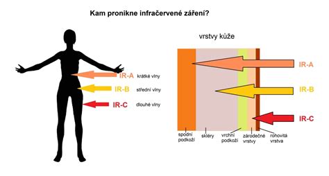 Ilustrácia infračerveného svetla prenikajúceho do pokožky