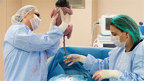 infografika porovnávajúca spontánny pôrod a cisársky rez