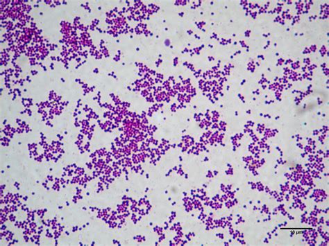 Ilustrácia baktérie Staphylococcus aureus pod mikroskopom