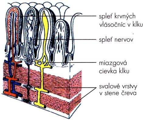 Ilustrácia tenkého čreva s poškodenými klkmi
