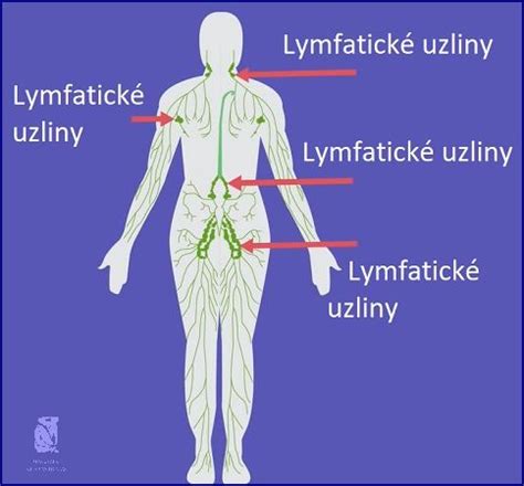 Ilustrácia lymfatických uzlín u detí