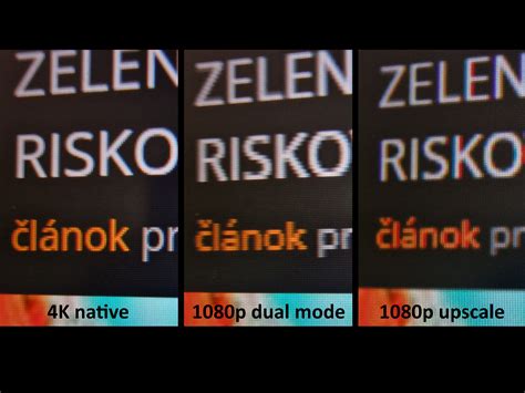 Porovnanie bežného a harmonického ultrazvukového zobrazenia