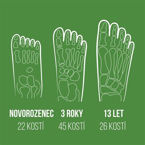 Infografika zobrazujúca vývoj detskej nohy a bežné deformácie