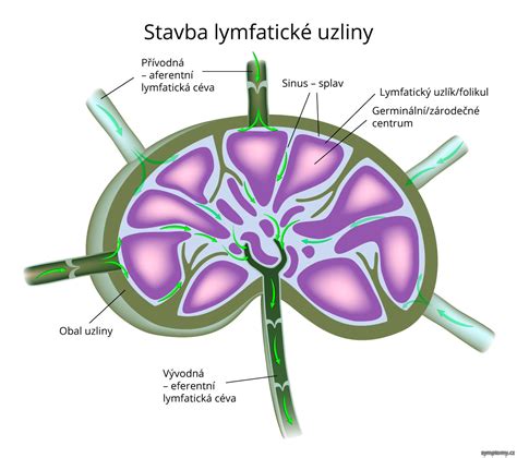 Ultrazvukové zobrazenie zväčšenej lymfatickej uzliny