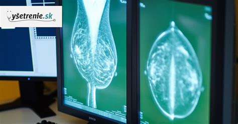 Ilustračná snímka ultrazvukového vyšetrenia prsníkov