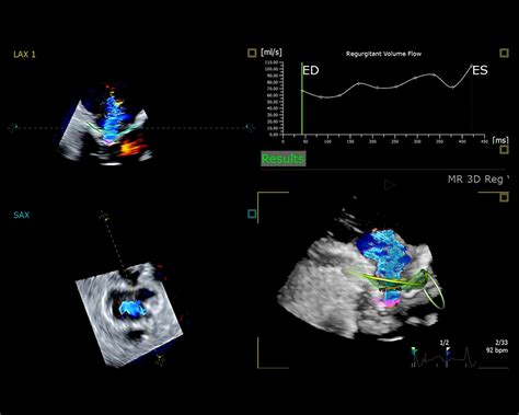 Schéma merania hĺbky mora pomocou ultrazvuku