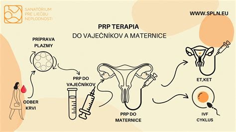 schéma odberu vajíčok pri IVF