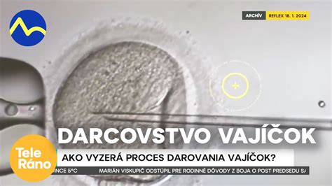 Ilustrácia procesu darovania vajíčok