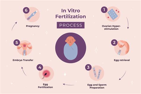 Infografika zobrazujúca kroky pre refundáciu IVF v zahraničí