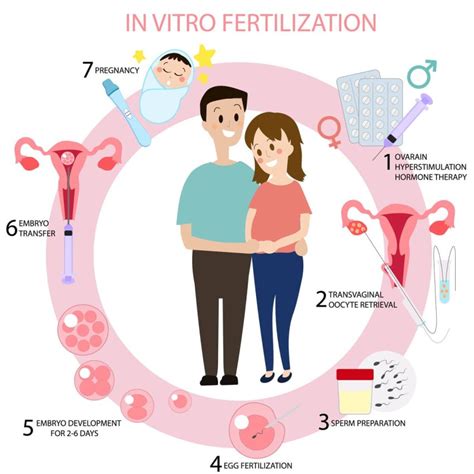Schéma procesu umelého oplodnenia (IVF).