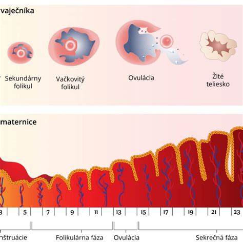 Anatómia maternice s vyznačenými anomáliami