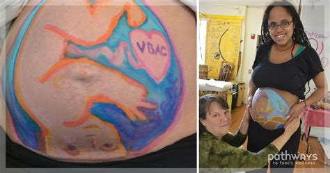 Ilustrácia techniky Belly Mapping