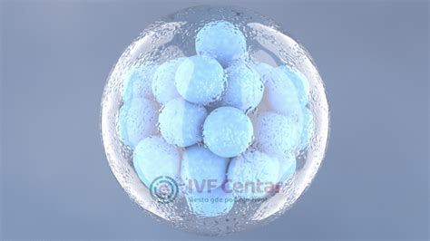 Schéma znázorňujúca proces IVF a potenciálne komplikácie.