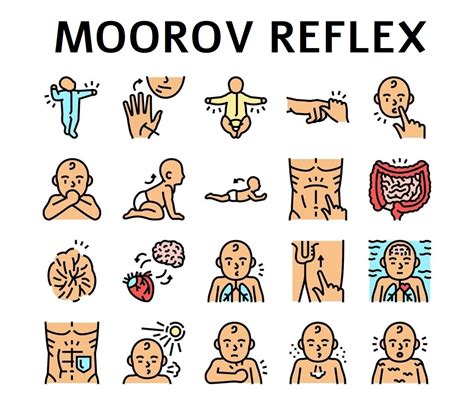 Ilustrácia zobrazujúca Moorov reflex u novorodenca