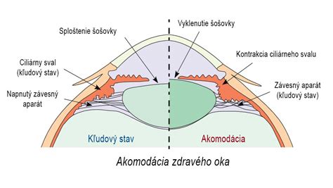 Infografika znázorňujúca proces akomodácie oka