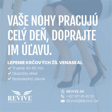 Ilustrácia kŕčových žíl na nohách