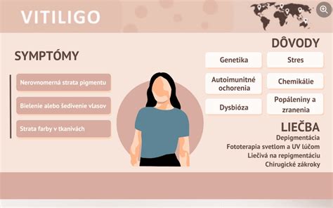 Infografika znázorňujúca možné miesta výskytu endometriózy