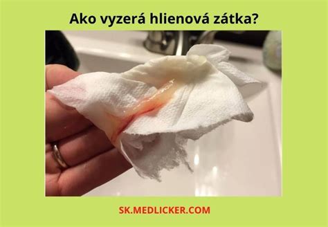 hlienová zátka