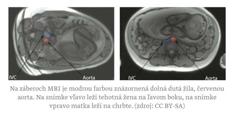 Zmeny v brušnej dutine počas druhého trimestra