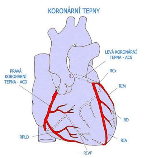 Ilustrácia srdcových tepien a zobrazenie koronárnej angioplastiky