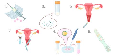 Proces IVF krok za krokom
